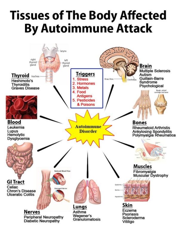 What Is An Autoimmune Disease Naturopath Solutions